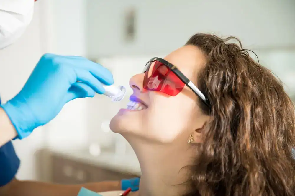 Teeth Whitening Laser Method Brighton-Hove Brighton & Hove